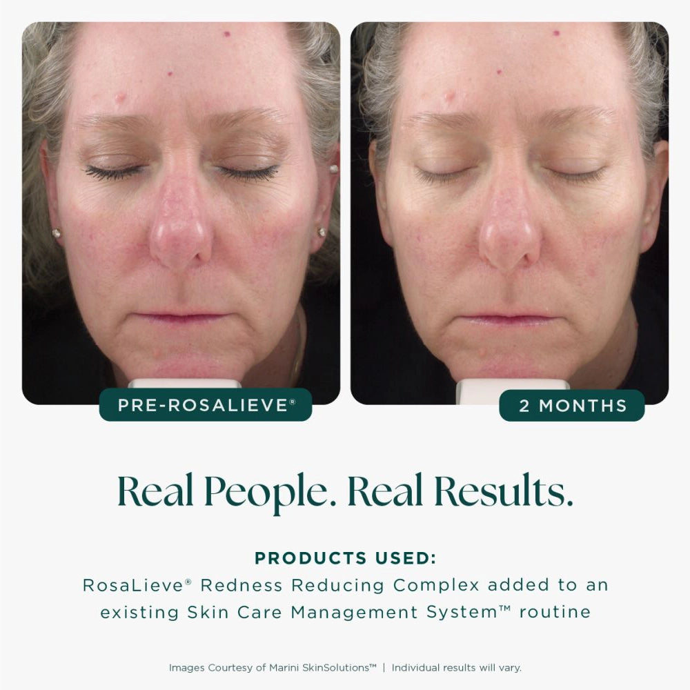 Jan Marini RosaLieve verpakking – serum voor zichtbare roodheid en gevoelige huid