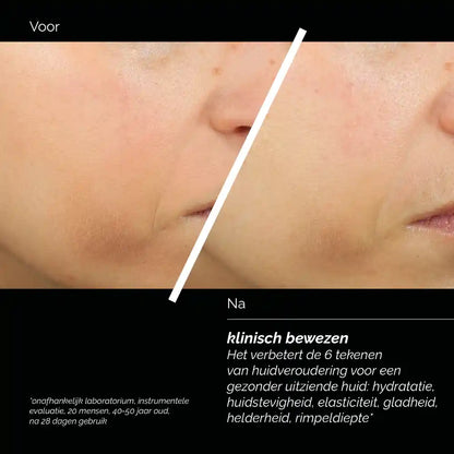 Skin Regimen LX Tripeptide Gel Cream 50ml voor een comfortabeler huidgevoel