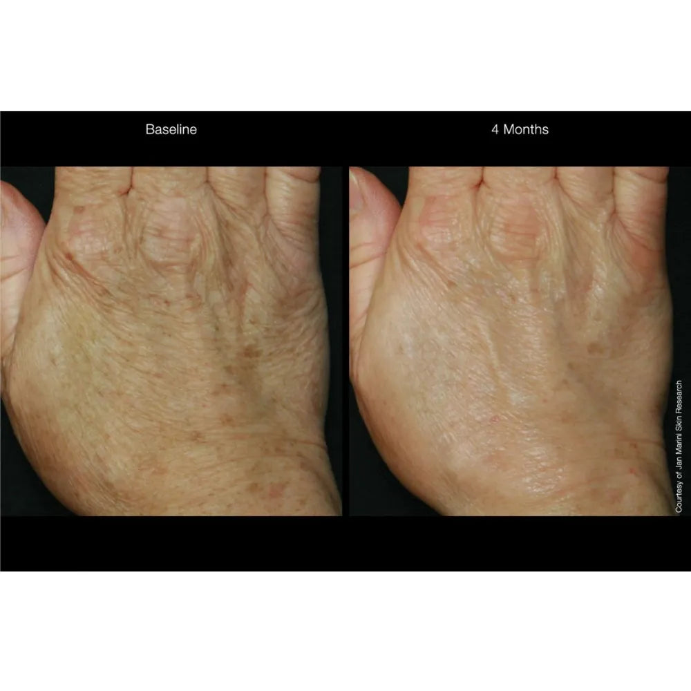 Jan Marini ReNu Corrective Hand Complex - 28gr