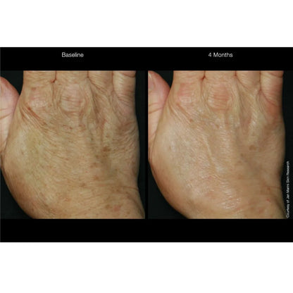 Jan Marini ReNu Corrective Hand Complex - 28gr